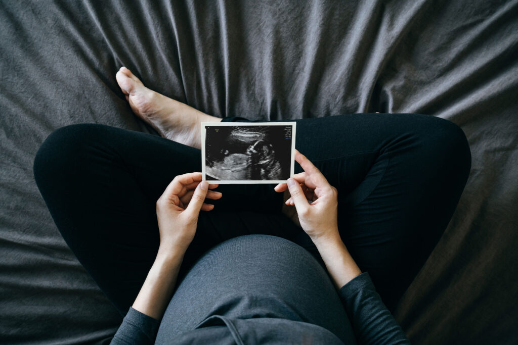 A high-angle photograph of a pregnant person sitting cross-legged on a bed and holds a sonogram of a baby.